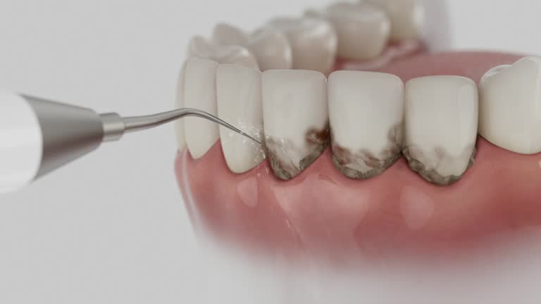 Trusted Wisdom Tooth Removal service in Wixom, MI - Dentist Open Now